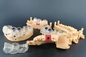 치의료 생체조직이나 기관과 잘 교합할 수 있는 고속도를 위한 자동 3D 수지 프린터