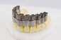 치아 보석 기술을 위한 한 개의 섬유 레이저 3D 금속 프린터