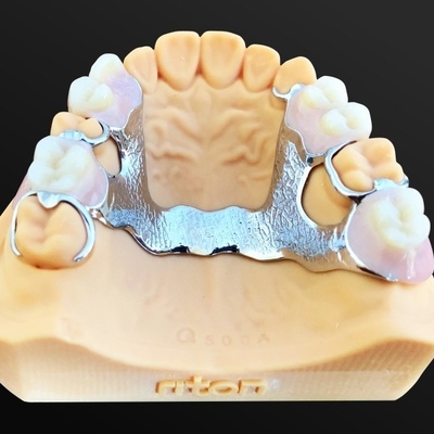 크라운과 부분적 프레임을 위한 리톤 치아 3D 프린터 특수 날염 장비