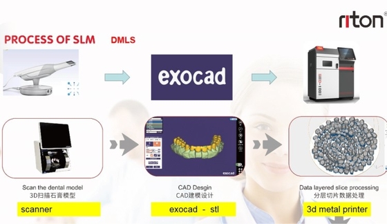 FDA 치아 3D 프린터 작은 사이즈는 모든 연구소 고속도를 적응시킵니다